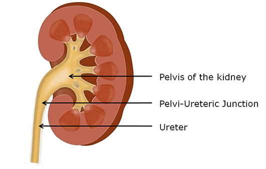 image of where kidney pain is felt